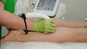 A close-up capturing the precision of laser hair removal. The powerful laser effectively removes unwanted hair, revealing smooth and beautiful skin.