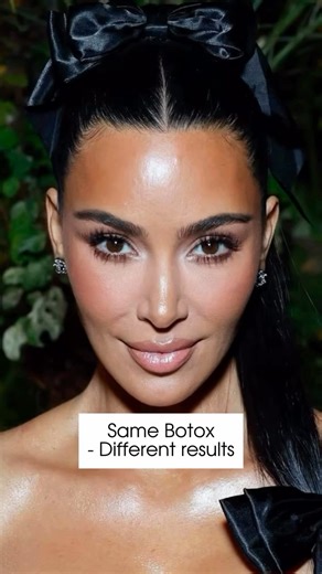 💉✨ Same Botox. Different Placement. Totally Different Look. ✨💉 Botox isn’t one-size-fits-all—it’s all about placement and precision. The same product can deliver completely different results depending on your goals: 👁️‍🗨️ Brow Lift: Opens up the eyes for a refreshed, youthful look. 😌 Forehead Smoothing: Softens lines for a calm, relaxed appearance. 😏 Frown Line Treatment: Reduces that “angry” or “tired” look. 😊 Lower Face Botox: Creates balance and softens a square jawline. At Health Hori