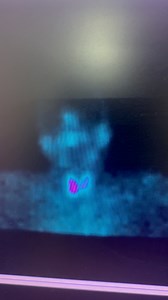 Salivary scintigraphy. #nuclearmedicine #fblifestylechallenge #radiotracers #GammaCamera | Nuclear Medicine imaging and Theranostics