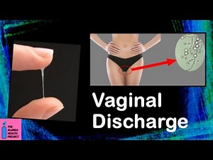 Vaginal Discharge │ What is Normal, What is Abnormal