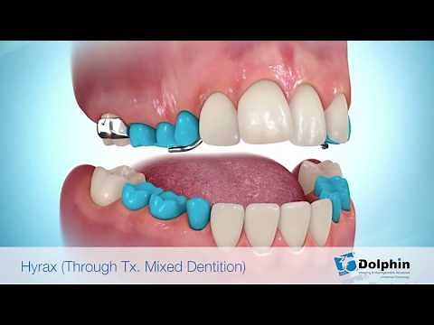 Dolphin Imaging & Management Solutions: April 2018 Aquarium© Software video sampler