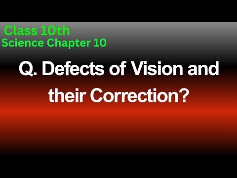 Defects of Vision and their Correction