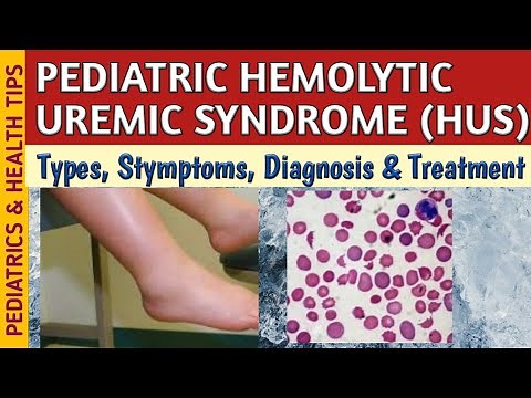 Hemolytic Uremic Syndrome (HUS) Symptoms, Diagnosis & Treatment In Children