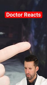 Doctor Reacts to Strange “Hair” on Finger 🫤 | Doctor ER