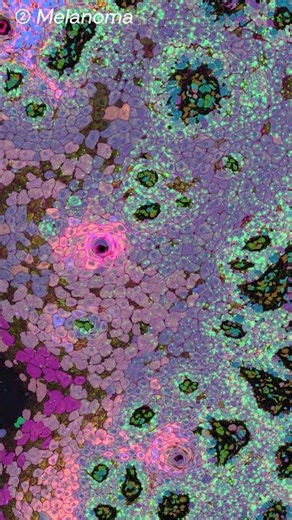 Check out these mesmerising spatial images from #qimrberghofer NCSTAR labs