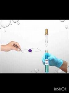 Capsule staining by hiss method by chauhan Priyanshiba #microbiology #biology
