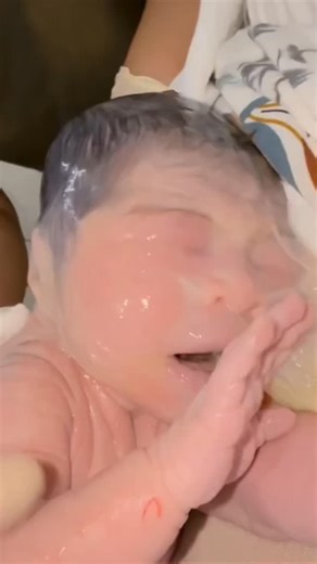 1K views · 98K reactions | The Amniotic Sac and Fluid. Newborn baby  殺  #newborn #newborns #bindiyasarraff | Bindiya Verma | Facebook