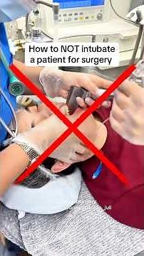 How NOT to intubate a patient. #medical #anesthesia #anesthesiology #anesthesiologist #doctor #meded