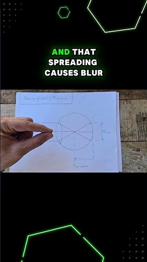 Why You Need Glasses + How They Work - In Simple Drawings