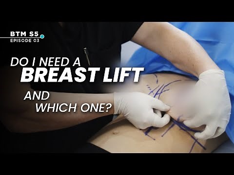 The TRUTH About Breast Lifts: Do You REALLY Need One? | BTM5 Ep.3
