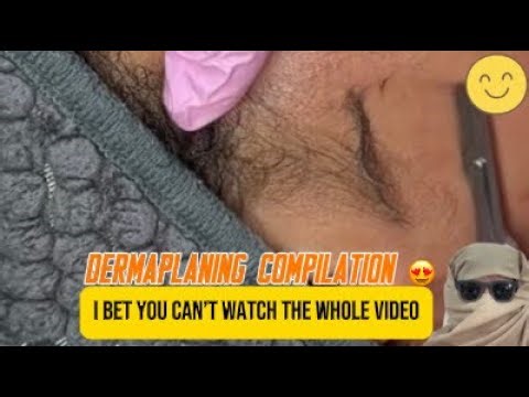 Satisfying Dermaplaning Compilation | Explaining Dermaplaning & Peach Fuzz Removal! 😍