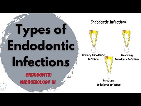 Types of Endodontic Infections | Endodontic Microbiology Part III