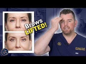 EndoBrow Lift (an advanced approach to browlifting)