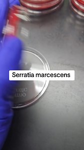 Microbiology ❤️❤️ #lablife #microbiology #bacteriology | Lab life