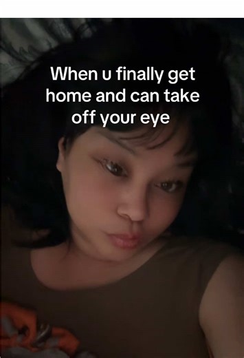 🧿 #prostheticeye | Prosthetic Eye