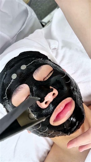 This AI facial treatment is going viral