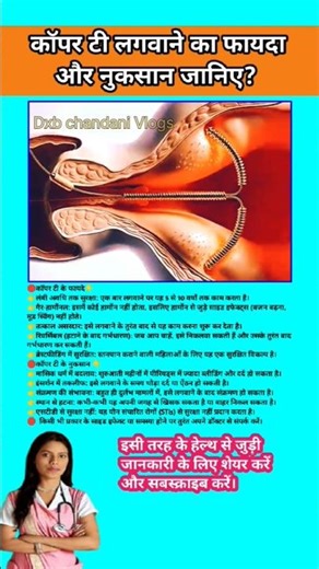 कॉपर टी लगवाने का फायदा और नुकसान जानिए?Copper-T Benefits & Side Effects ll #viral #shorts