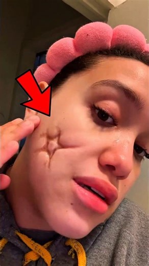 She Made the Biggest Mistake of Her Life… It Marked Her Face 😳