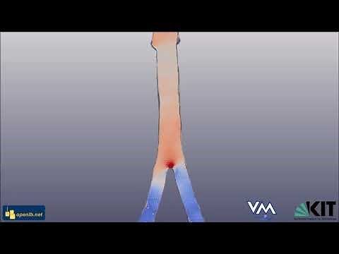 Blood Flow Simulation in the Aorta in 3D with LBM -- Simulation in Process Engineering