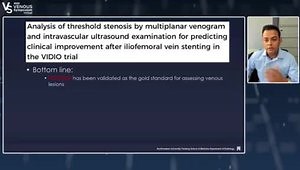 Treatment of Nonthrombotic Iliac Vein Stenosis: Where Is the Evidence?