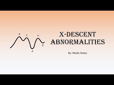 x descent abnormalities in JVP waveform (absent, prominent) - definition, causes, pathophysiology