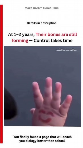 🩻 At 1-2 years, Their bones are still forming 🦴 - control takes time ⏳ | MDCT