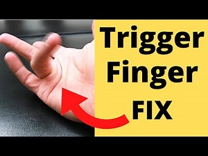 FIX Trigger Finger in 5 Minutes: 4 Steps 🤞❌