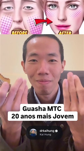tira 20 anos do seu rosto. E a medicina explica o porquê. consulta “link no perfil Não é filtro. Não é botox. É uma técnica de mais de 3.000 anos que as chinesas usam até hoje para manter o rosto jovem, firme e sem toxina acumulada. O Guasha facial não é massagem. É uma raspagem precisa sobre os meridianos da face que: 🧬 Quebra a fibrose formada por anos de tensão muscular ☠️ Expulsa toxinas presas no tecido — aquelas que viram mancha, olheira e flacidez 🩸 Ativa a microcirculação — o sangue fr