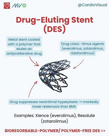 Different types of stents: bare-metal, drug-eluting, bioresorbable-polymer and polymer-free stents!