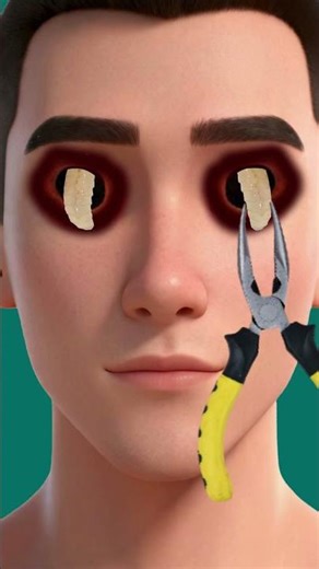 Satisfying Eye Cleaning ASMR Animation | Oddly Relaxing Parasite Removal #asmr #shorts #satisfying