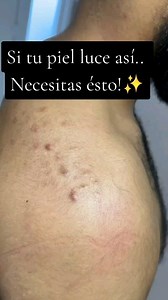 21K views · 282 reactions | ¡La magia en cuidado de la piel con...