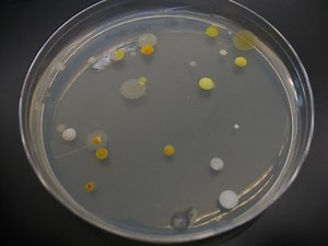 Hybrid Micro Lab 2: Ubiquity of Microorganisms, Culturing and Isolating Bacterial Colonies