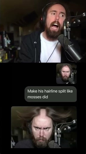 holy Moses hairline 💀 #asmongold #asmonbald