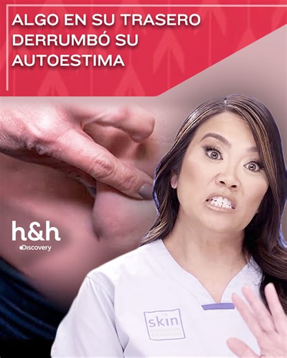 7.4K views · 50 reactions | Para una hermosa adolescente, verse en traje de baño parece un sueño inalcanzable, por culpa de una anomalía en la parte baja de su espalda que cambia la forma armónica de su trasero. Ahora, la esperanza de recuperar su silueta, reposará en manos de la Dra. Sandra Lee. ¿Lo conseguirá? #DraSandraLee | Discovery Home & Health | Facebook