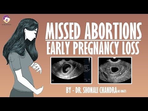 Missed Abortion : Early Pregnancy Loss : Clinical Scenarios : Dr. Shonali Chandra