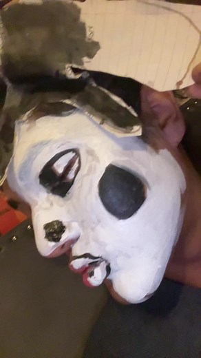 Understanding Hyperpigmentation Causes and Treatments