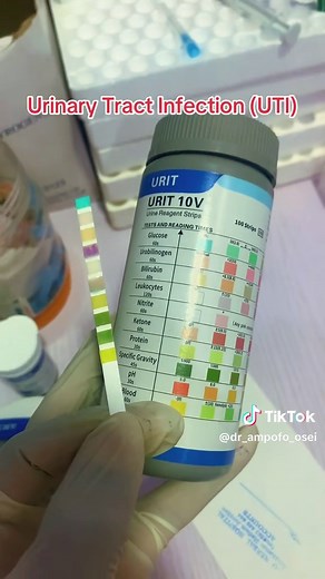 Urine Test (Urinalysis) . Positive Leukocytes indicating infection of the urinary Tract . #tiktoklive #livehighlights #healtheducation @MR. _EMEL _🖤 @AKOSUAH ❤️🦋🍏🧸 @Gela_xx🦋😍