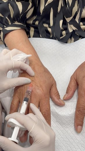 6 comments | Hands down, Profhilo is the ultimate solution for...