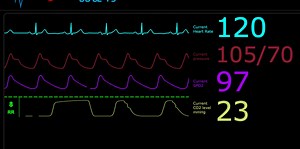 What's going on with the yellow line...ETCO2??? Are you struggling with ETCO2 waveforms? Want to talk to an instructor and become more comfortable reading and responding to them? FREE & RACE APPROVED FOR SUBSCRIBERS! Troubleshooting Waveforms! February 6th, 2025 8:00-9:00pm EST (5:00-6:00p PST) Speaker: Kristen Cooley, BA, CVT, VTS (Anesthesia) Log into MY ACCOUNT > Drop Down My Account Menu > Subscribers Only to register: https://education.vetteamtraining.com/ Not a subscriber and have FOMO? Co
