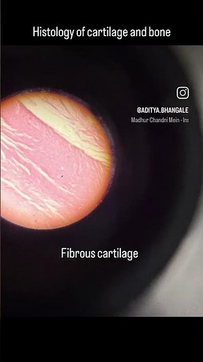 #mbbs #saharsa #snmih #anatomy #bones #cartilage #medico #studentlife