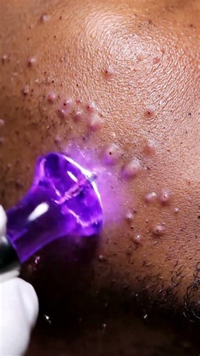 🧪 Glass High Frequency Electrode Showcase