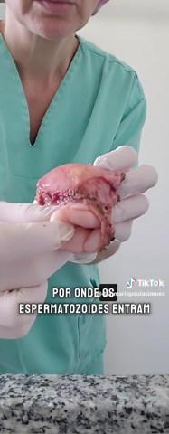 Cerclagem: O que Saber sobre Insuficiência Istmica Cervical