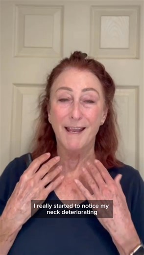 Lynne McGranger swears by this miracle bottle—a game-changer for anyone noticing crepiness or sagging skin. Try it for yourself! ✨ | BOOST LAB Co.