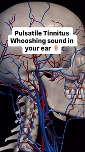 🔊 Do you hear a constant whooshing sound in your ear (pulsatile tinnitus)? This could be linked to pressure, circulation, and misalignments in the upper neck. Upper cervical care gently restores proper balance and can help your body heal naturally—bringing relief from the noise! 🌿👂✨ | Upper Cervical Chiropractor Near Me