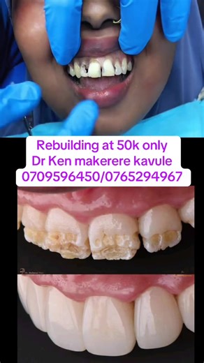 CRYSTAL DENTAL HUB (@crystal.dental.hub)’s videos with Buwooma - A Pass & Kaboo