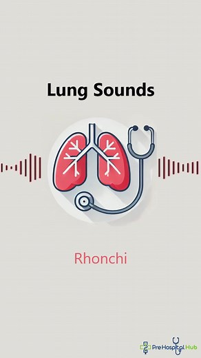 Rhonchi Sounds: Understanding Lung Sounds in Medicine