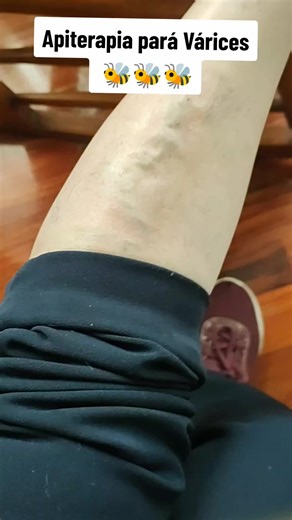 Apinatural terapia medicinal on TikTok