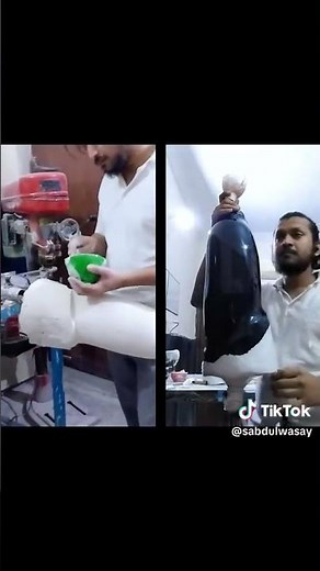 ICS method above the knee prosthetic socket modification and lamination