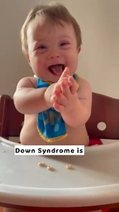 11 reactions · 13 shares | Join us in raising awareness and celebrating diversity today, World Down Syndrome Day  ➡️ Share this post to show what Down Syndrome really is. #WhatMakesYouDifferentMakesYouBeautiful ✨ | Fun and Function | Facebook