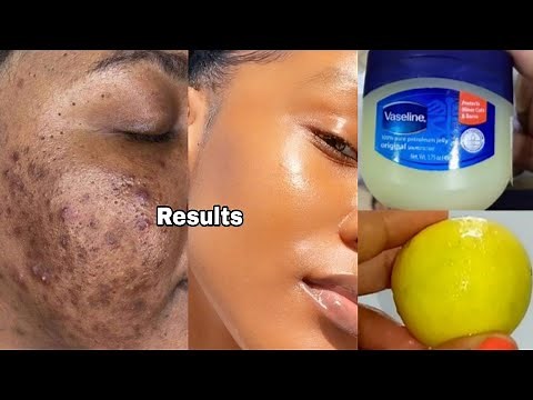 How to apply vaseline and lemon on face/ apply vaseline on your skin and see the magic